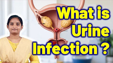 What is Urine Infection in Women? UTI Statistics | Urinary Infection Treatment | Homeopathy Medicine
