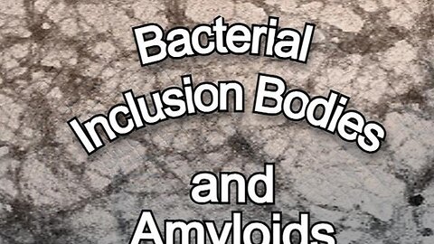 "Unraveling the Mysteries of Bacteria Inclusion Bodies and Amyloids: A Deep Dive"