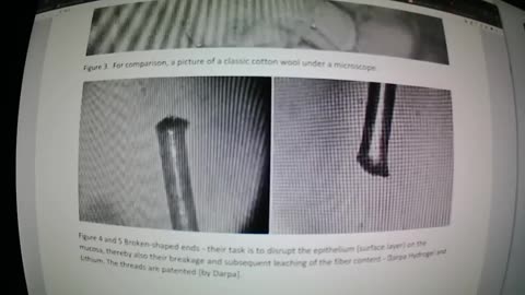 Swab Test - Confirmation of Genocide