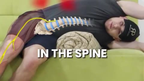 💥 What is Sciatica?