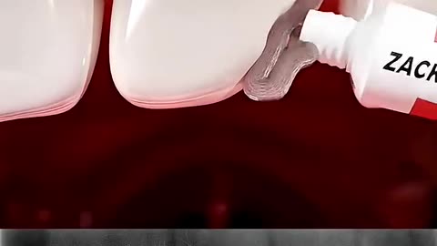 How to teeth care trending video popular video 📸 viral 🆒