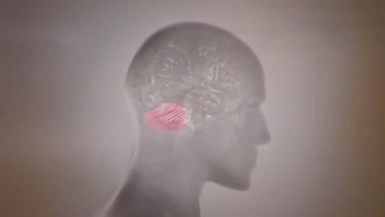 Parkland Docs v Humes & Boswell on JFK's Extruding Cerebellum