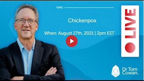 Chickenpox Live Webinar from August 27th, 2021