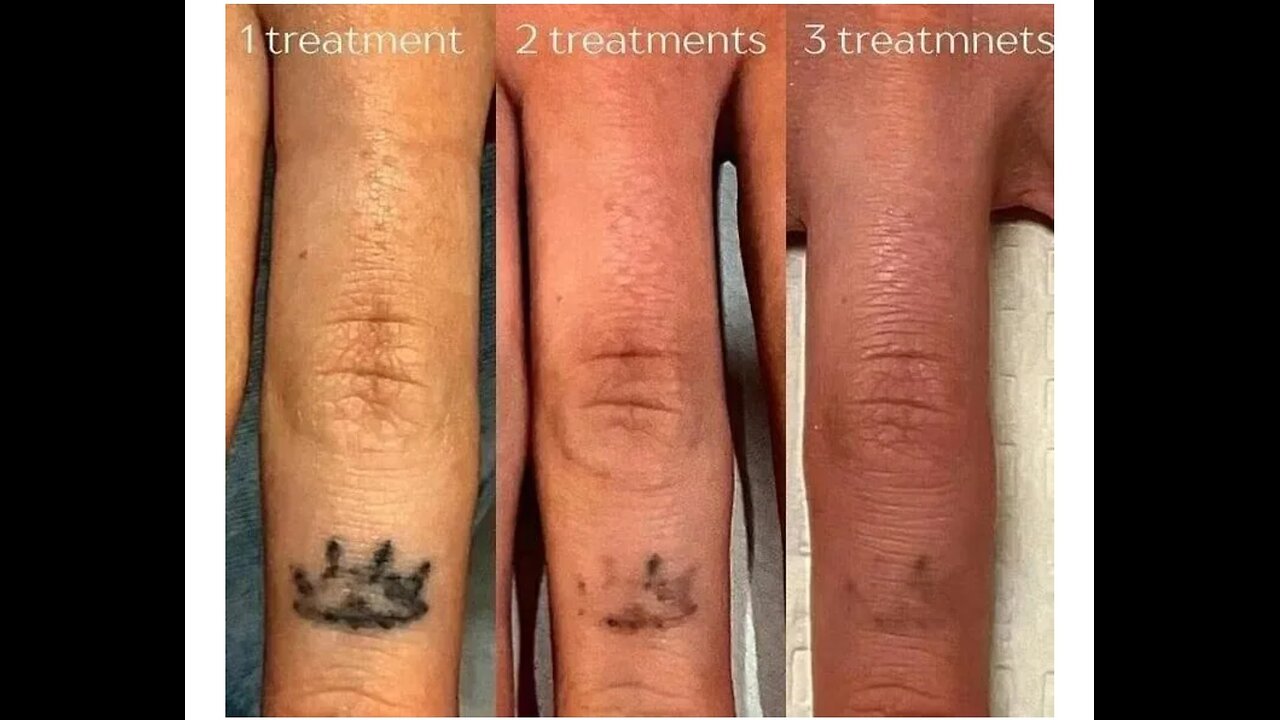 DEMOCRATS are silencing CONSERVATIVES