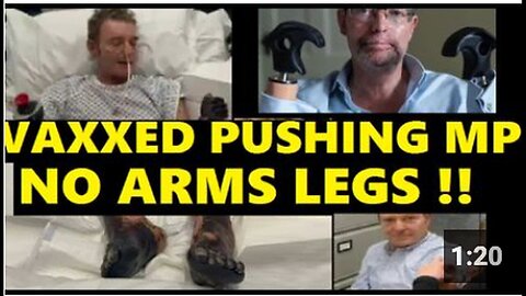 "Amputee VAX MP: Arms and Legs Severed!"