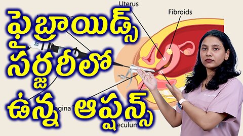 ఫైబ్రాయిడ్స్ సర్జరీలో ఉన్న రకాలు Types of Fibroids Removal Surgery Myomectomy Operation Homeopathy