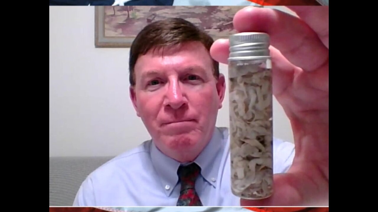 White Fibrous Clots From CV19 Vax Contagious - Tom Haviland