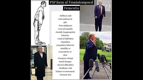 We Need to Talk About Donald Trump's Mental State