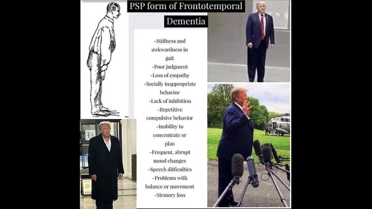 We Need to Talk About Donald Trump's Mental State