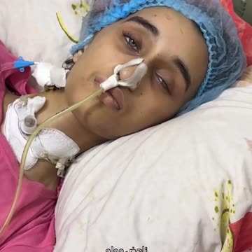 Batoul Ahmed Al-Mashharawi, a 17-year-old girl, was injured by a shr-ap-nel in her brain