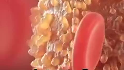 Honeybee Venom Kills Cancer Cells!