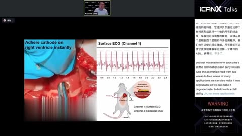 IcanX Talks: Merging Human-Machine Intelligence with Soft Materials Technology - Xuanhe Zhao