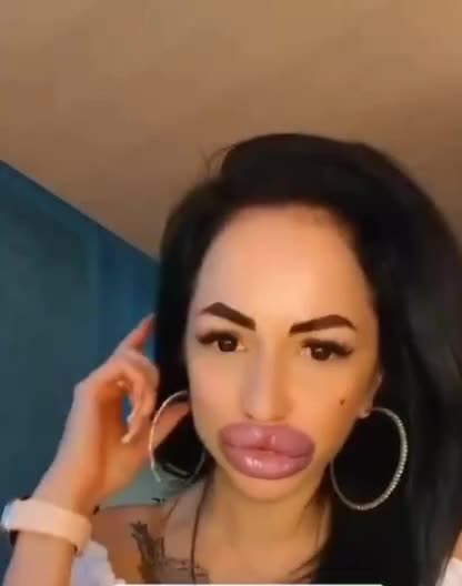 Misslungene kosmetische OP