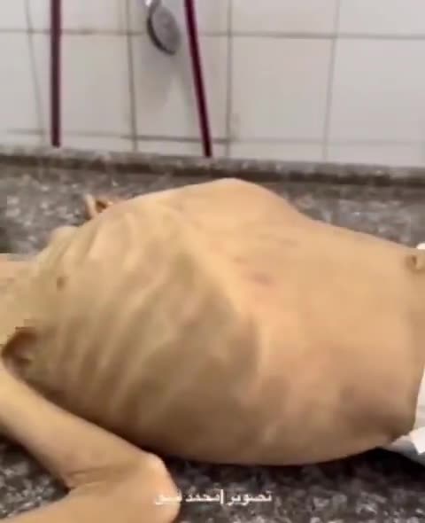 La bambina palestinese di 4 anni Razan Abu Zaher è morta.