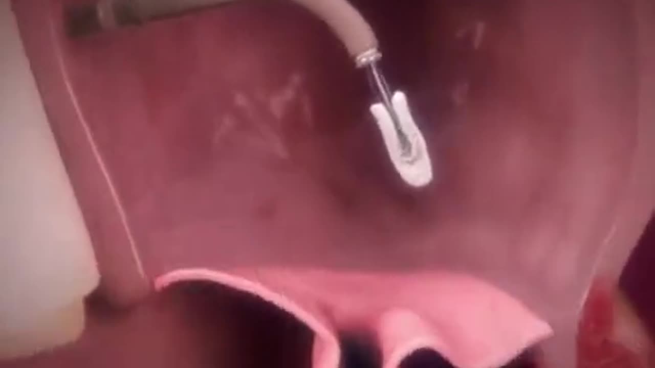 Heart Mitral Clip Procedure 3D Animation