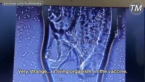 another-living-organism-found-inside-pfizer-mark-of-the-beast-quot-vaccine