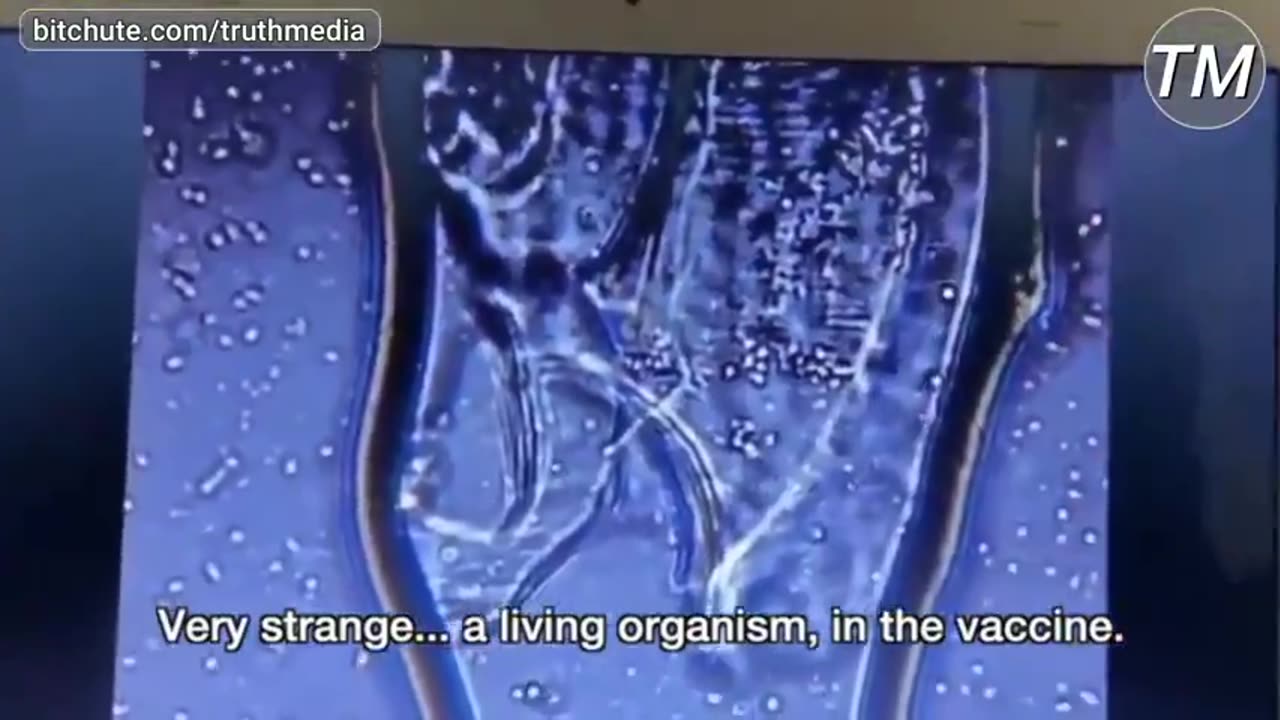 another-living-organism-found-inside-pfizer-mark-of-the-beast-quot-vaccine