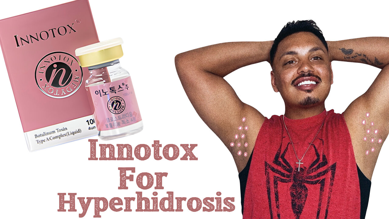 Join Me As I Tackle Underarm Hyperhidrosis (Excessive Sweating) With Innotox!