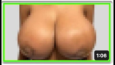 "Woman's Breasts Grow from B to G Cup Due to VAXX Poisoning"