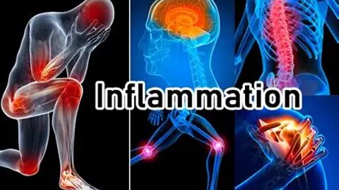 Millions of people have Inflammation and How to fix it Naturally with Dr Dhand