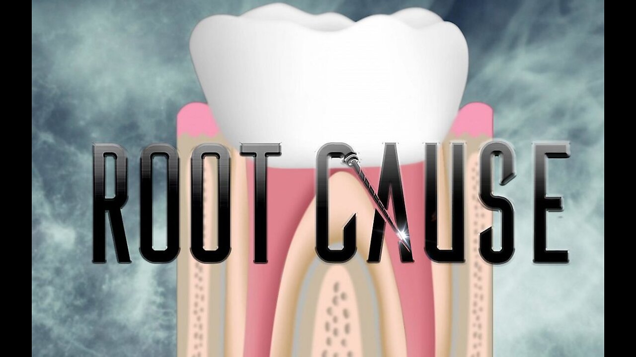 Root Cause Documentary