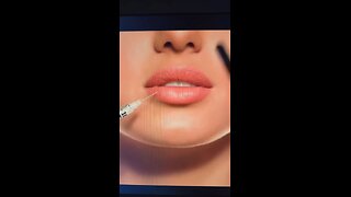 BOTOX IS POISON 💉 THE HIDDEN TRUTH THEY DON’T WANT YOU TO KNOW ⚡🔥
