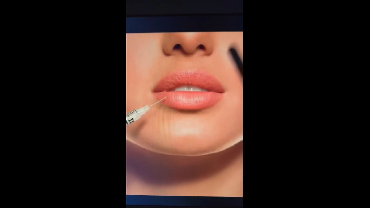BOTOX IS POISON 💉 THE HIDDEN TRUTH THEY DON’T WANT YOU TO KNOW ⚡🔥