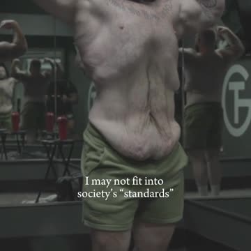 An amazing weight loss