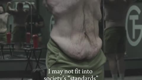 An amazing weight loss