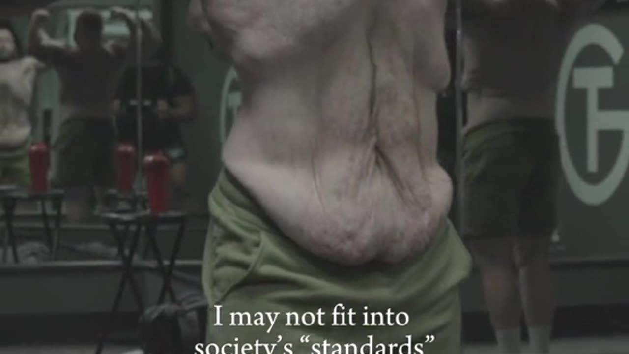 An amazing weight loss