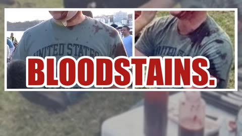 Fact Check: Fake Image Does NOT Show Crisis Actor At Bondi Beach As Fake Blood Makeup Is Applied