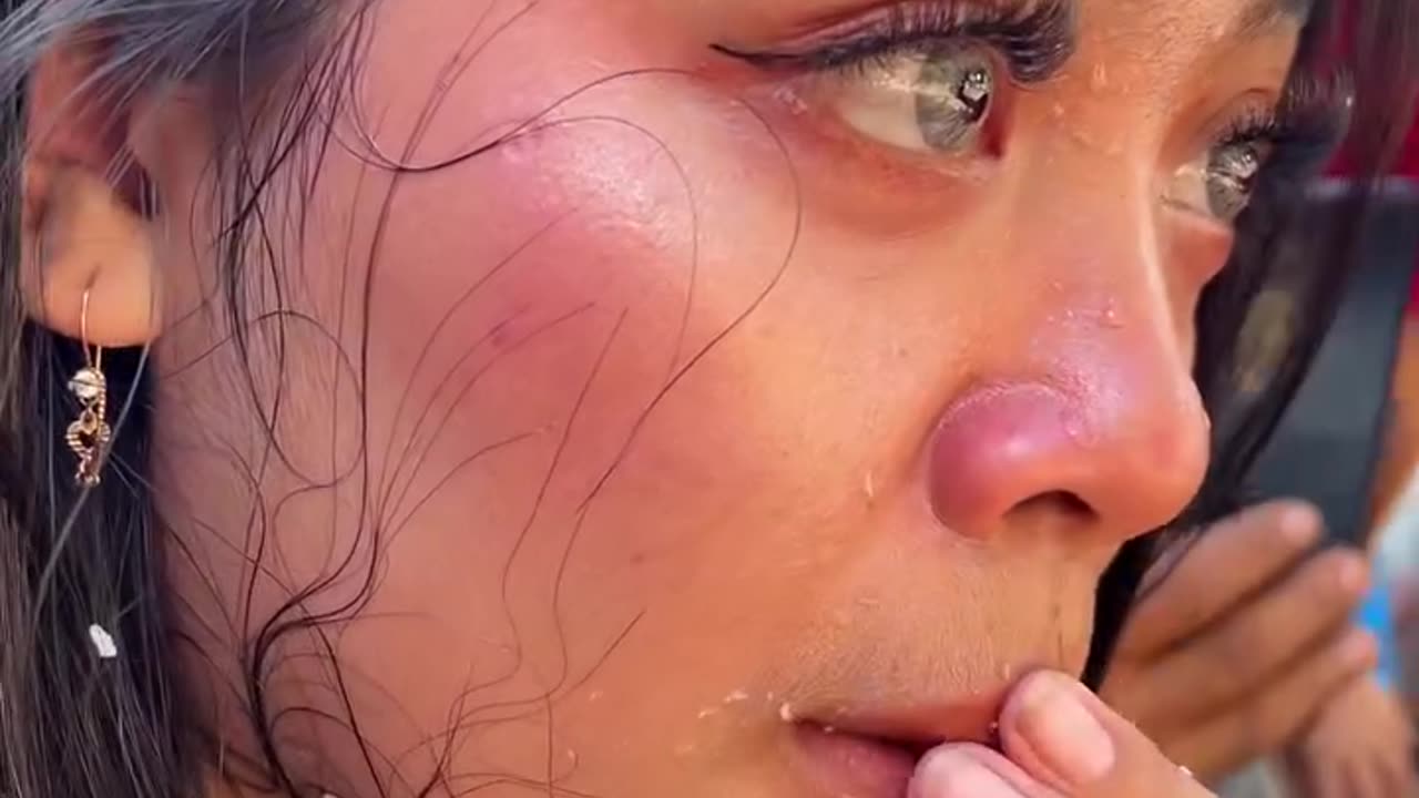 Coconut peel from women's teeth strangles in life.