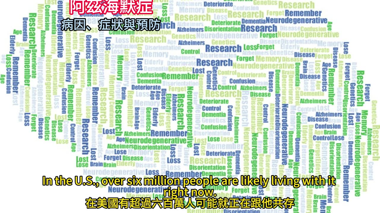 阿茲海默症 病因、症狀與預防