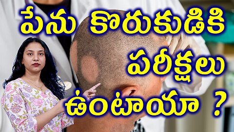 పేను కొరుకుడుకి పరీక్షలు ఉంటాయా?Tests & Investigations for AlopeciaAreata or SpotBaldness Homeopathy