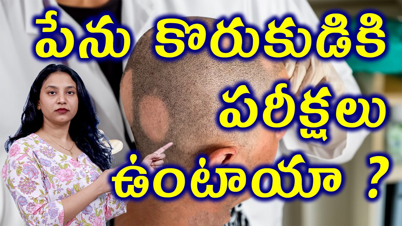 పేను కొరుకుడుకి పరీక్షలు ఉంటాయా?Tests & Investigations for AlopeciaAreata or SpotBaldness Homeopathy