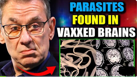PARASITE ENTITIES IN THE BRAINS OF THE VAXXED