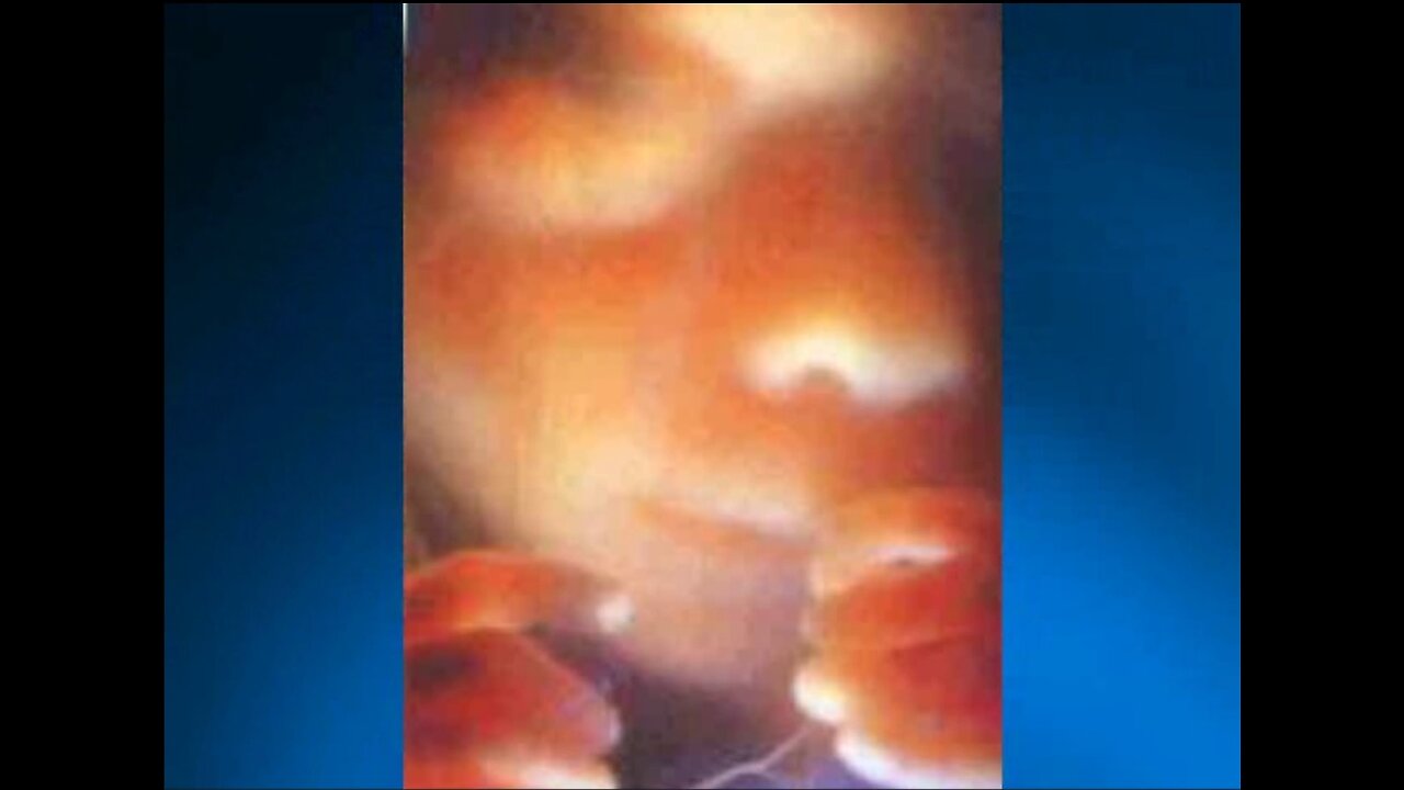 2012 06 23 - Unborn Jesus Theme Music