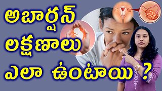 గర్భస్రావం లక్షణాలు ఎలా ఉంటాయి? Signs of miscarriage in PCOS Homeopathy Treatment Cure Medicine