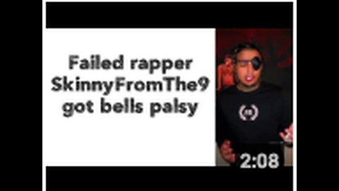 "SkinnyFromThe9, Unsuccessful Rapper, Diagnosed with Bell's Palsy"