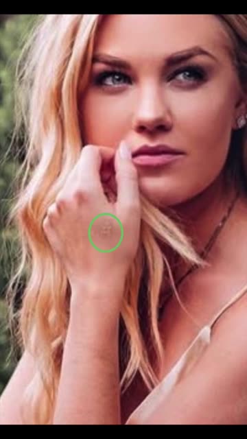 PEOPLE ARE NOTICING THE BRANDING MARKS ON ERIKA KIRK’S HANDS, what are they?