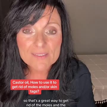 How to get rid of skintags, moles and warts naturally