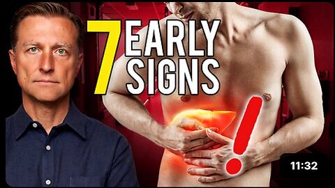 7 Early Signs of Liver Damage