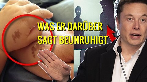 Elon Musks Theorie über Muttermale und Wiedergeburt wird dich schockieren