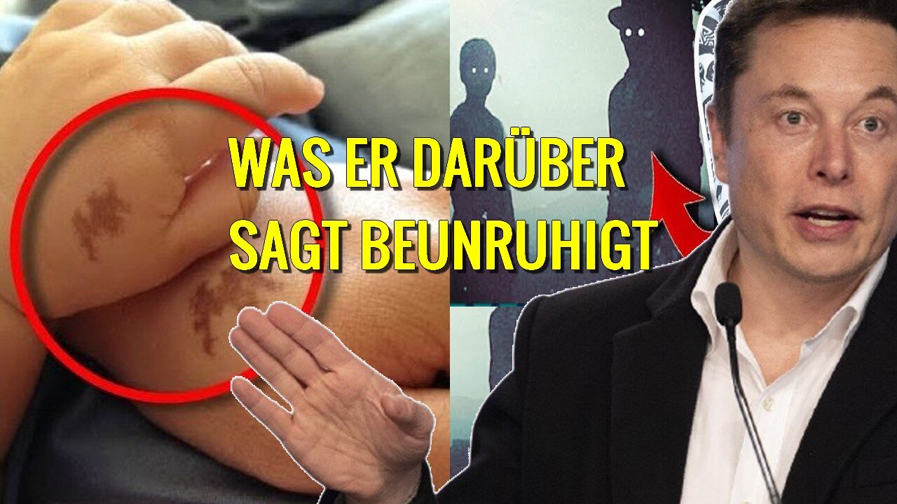 Elon Musks Theorie über Muttermale und Wiedergeburt wird dich schockieren