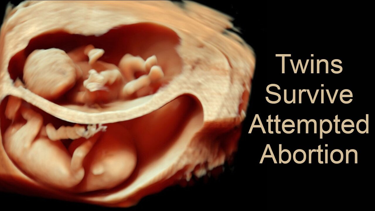 Twins Survive Attempted Abortion