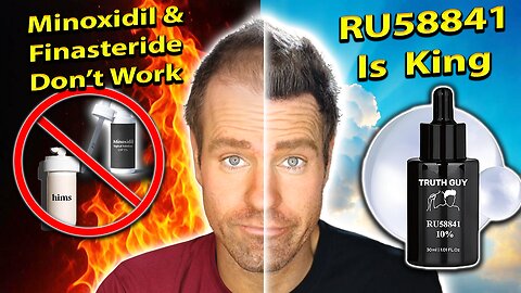 RU58841 is the BEST Hair Loss Product Ever! DHT Blocker