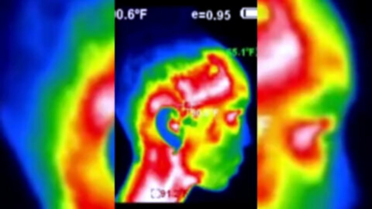 TI SCAN IMPLANTS • TEMPERATURE • FREQUENCIES
