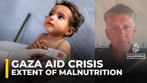 UNICEF spokesman _shocked_ by extent of malnutrition in Gaza
