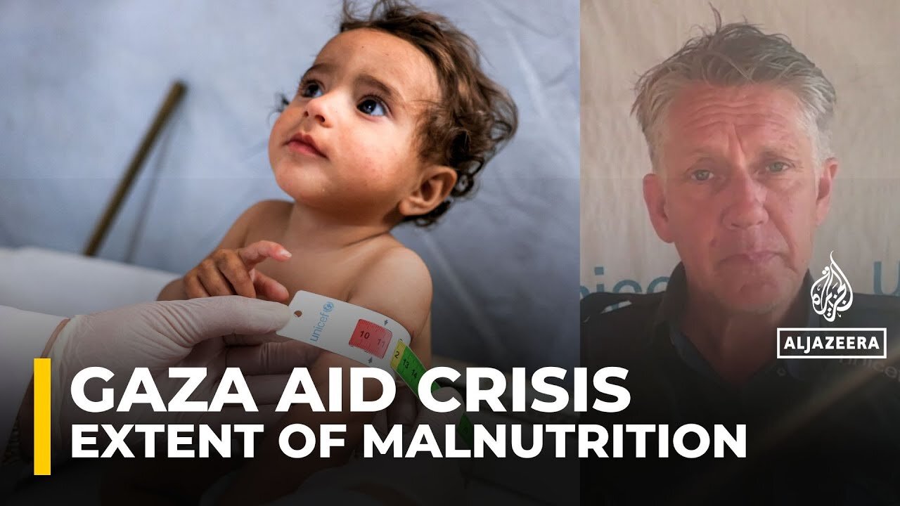 UNICEF spokesman _shocked_ by extent of malnutrition in Gaza