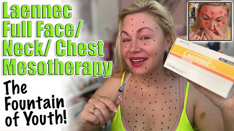 The Fountain of Youth, aka Laennec Full Face/ Neck/ Chest Meso | AceCosm, code Jessica10 saves